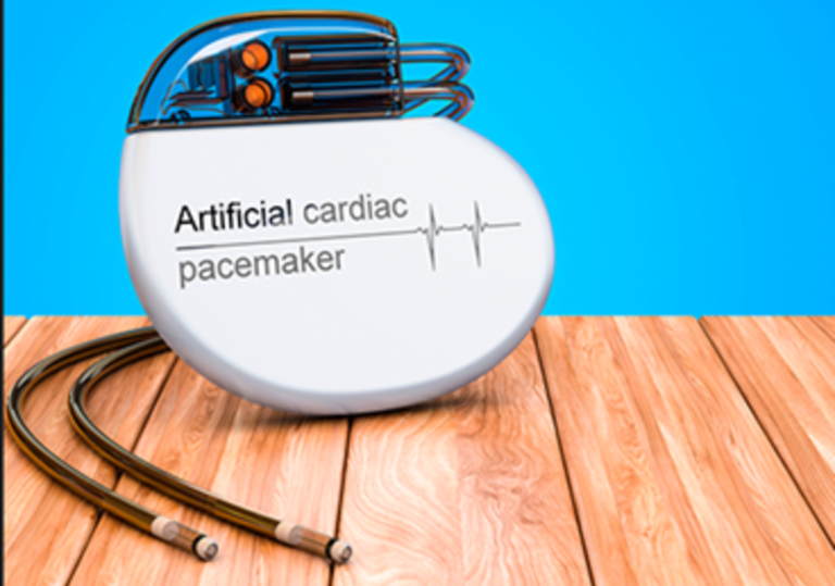 Entrada em vigor | Acordo-Quadro 1051/2024 – Cardioversores Desfibrilhadores Implantáveis e Pacemakers